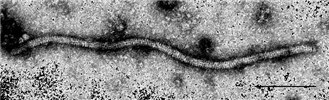 Knowledge Bank | Potato virus X
