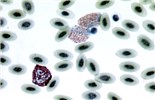 Cover for blood and circulatory system diseases of poultry