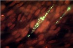 Cover for Rift Valley fever virus