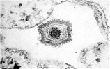 Cover for African swine fever virus