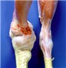 Cover for Streptococcus and Enterococcus infections in poultry