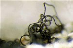 Mature conidia Conidia have matured and darkened.