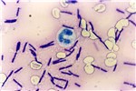Cover for Bacillus anthracis
