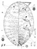 Female Maconellicoccus hirsutus (pink hibiscus mealybug); adult female, diagrammatic view.