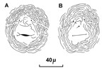 Cuticular patterns Meloidogyne incognita (root-knot nematode); posterior cuticular patterns of females.
(reproduced from Orton Williams KJ, 1973. CIH Descriptions of Plant-Parasitic Nematodes. Set 2, No.18. Wallingford, UK: CAB International.)