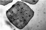 TEM Helicoverpa armigera (cotton bollworm); transmission EM of H. armigera NPV. Original image x 96,000.