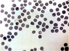 Cover for babesiosis