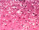 Cover for bovine spongiform encephalopathy prions as foodborne pathogens