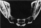 Cover for Brucella abortus as a foodborne pathogen