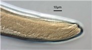 Male Meloidogyne incognita (root-knot nematode); male, spicule.