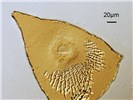 Male Meloidogyne incognita (root-knot nematode); male, perineal pattern.