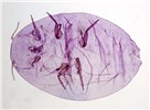 Adult female Phenacoccus solenopsis (cotton mealybug); live adult female has pale yellow body. Dorsum with a dark bar, spots on intersegmental areas of thorax and abdomen, with 18 pairs of lateral wax filament.