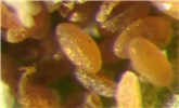 Ova Aulacaspis yasumatsui (cycad aulacaspis scale); eggs. The orange color of the eggs (and also the females), helps distinguish this species from Pseudaulacapis cockerelli, which is somewhat similar, infests cycads and other plants, but is yellow rather than orange. Florida, USA.