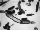 Cover for Coxiella burnetii as a foodborne pathogen (Q fever)