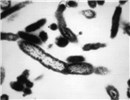 Cover for Coxiella burnetii