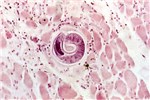 Cover for Trichinella