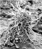 SEM SEM of a pycnium of cedar-apple rust fungus with a few periphyses extended and some pycniospores. (Nectar drops were removed during preparation.)