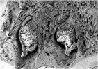SEM SEM cross-section of an apple leaf showing young aecia cluster-cups of the cedar-apple rust fungus on the underside of the leaf.