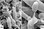SEM SEM of a gelatinous spore horn from a cedar-apple rust gall. Teliospores of the cedar-apple rust fungus with slight constriction at the crosswall and single teliospore bearing promycelium (a) and formation of secondary basidiospore on a pointed sterigmata (b). Other basidiospores can be seen on the left.