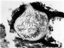 Asci and ascospores Transverse section of mature subepidermal pseudothecium showing asci and ascospores.
