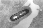 Cover for Listeria monocytogenes as a foodborne pathogen