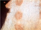 Early skin lesions