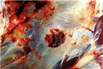Pathology Lesions in muscle.