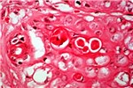 Histology Inclusion bodies.