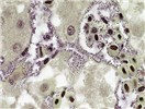 Cover for Pasteurella multocida