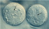 Cover for Plasmodium relictum