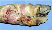 Cover for proximal limb disorders in cattle - soft tissues