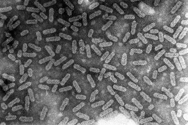 Virus particles Alfalfa mosaic virus particles.
Reproduced with permission from IACR Rothamsted: http://www.res.bbsrc.ac.uk/cdm/plantpath/