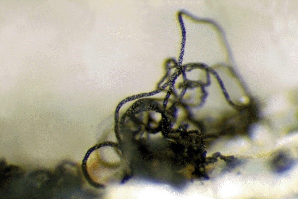 Mature conidia Conidia have matured and darkened.