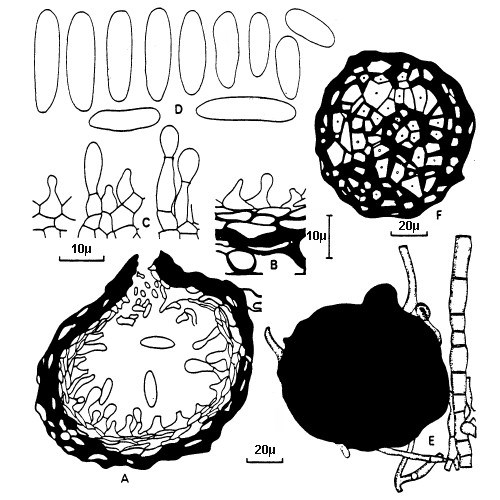 M. phaseolina - line drawing A, Vertical section of pycnidium; B, part of pycnidial wall and conidiophores; C, conidiophores and young conidia; D, conidia; E, sclerotium; F, section of sclerotium. CMI Descriptions of Pathogenic Fungi and Bacteria No. 275. CAB International, Wallingford, UK.