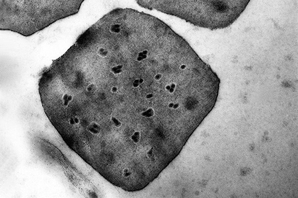 TEM Helicoverpa armigera (cotton bollworm); transmission EM of H. armigera NPV. Original image x 96,000.