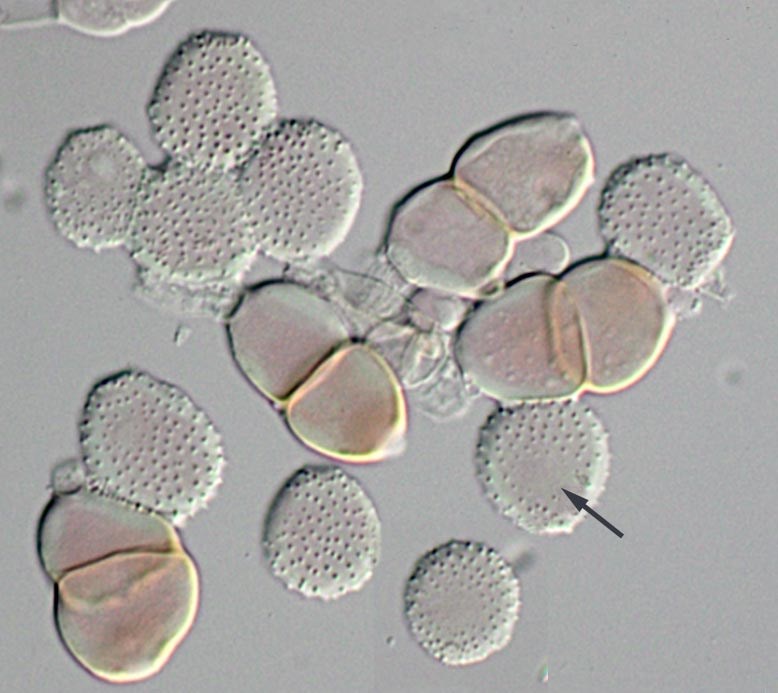 Uredospores and teliospores Puccinia psidii; uredospores and teliospores. Note tonsure (arrowed).