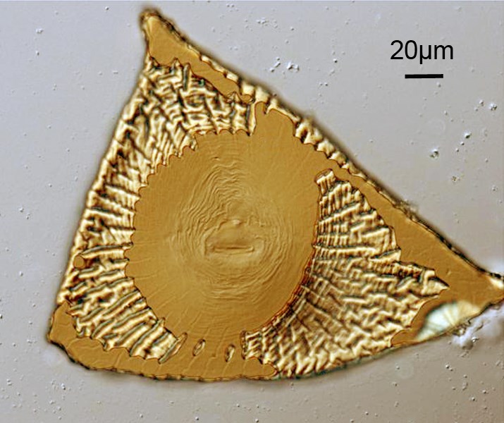 Male Meloidogyne incognita (root-knot nematode); male, perineal pattern.