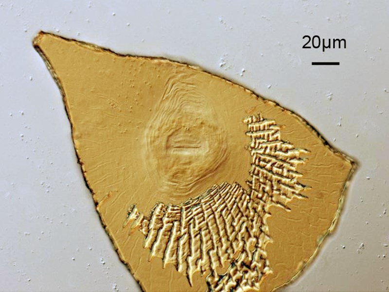 Male Meloidogyne incognita (root-knot nematode); male, perineal pattern.