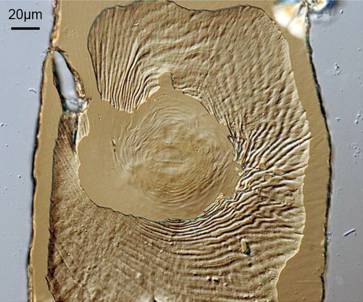 Male Meloidogyne incognita (root-knot nematode); male, perineal pattern.