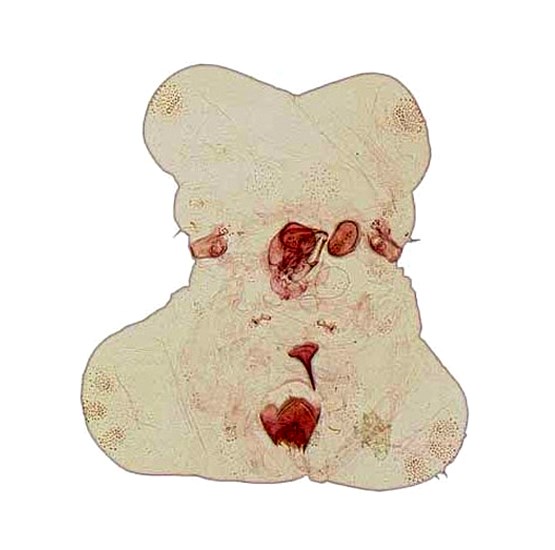 Adult Paratachardina pseudolobata (lobate lac scale); adult. ventral, adaxial, front view. Slide prep. USA.