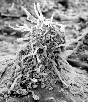 SEM SEM of a pycnium of cedar-apple rust fungus with a few periphyses extended and some pycniospores. (Nectar drops were removed during preparation.)