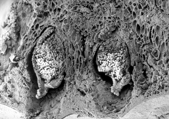 SEM SEM cross-section of an apple leaf showing young aecia cluster-cups of the cedar-apple rust fungus on the underside of the leaf.