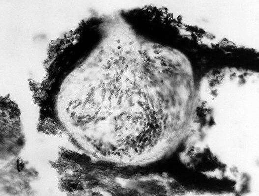 Asci and ascospores Transverse section of mature subepidermal pseudothecium showing asci and ascospores.