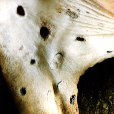 Advanced skin lesions