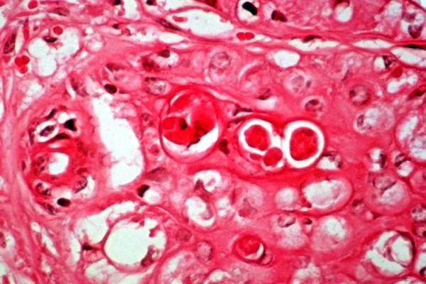 Histology Inclusion bodies.