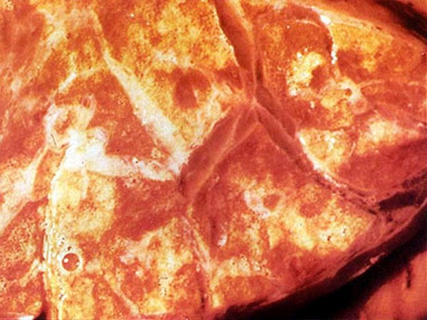 Pathology LSD lesions in the lung are areas of atelectasis and interlobular oedema.